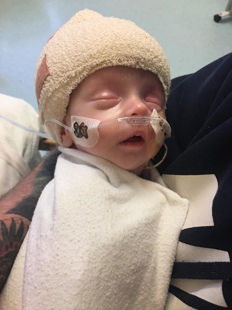 Tiny baby with tubes in nose and wearing wooly hat is asleep in Dad's arms 