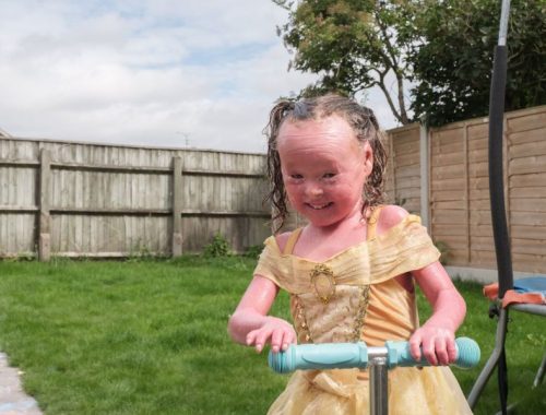 A girl wearing a yellow princess dress riding a scooter in her fenced garden